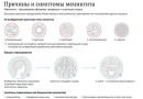 Количество заболевших менингитом в Хабаровском крае достигло почти шестидесяти человек